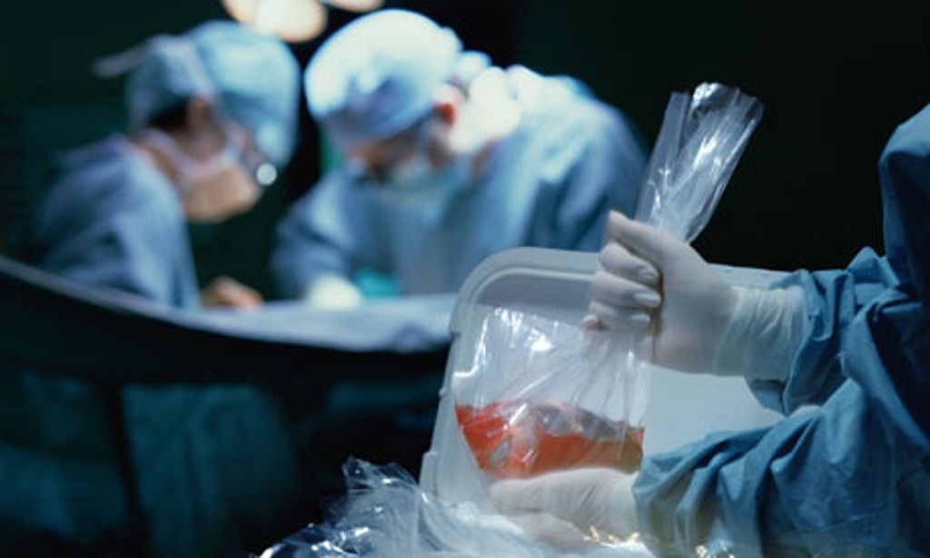 The Dark Side of Organ Transplants